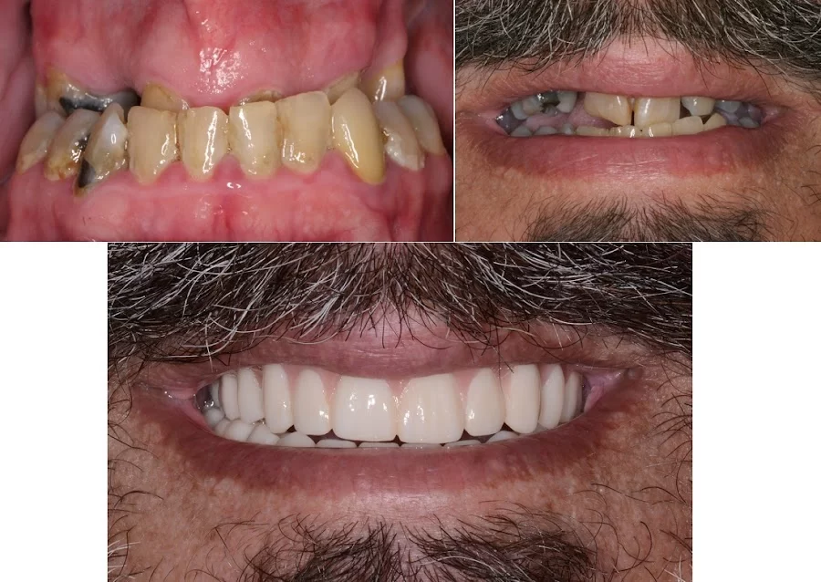 Rose Cosmetic & Family Dentistry Picture 8