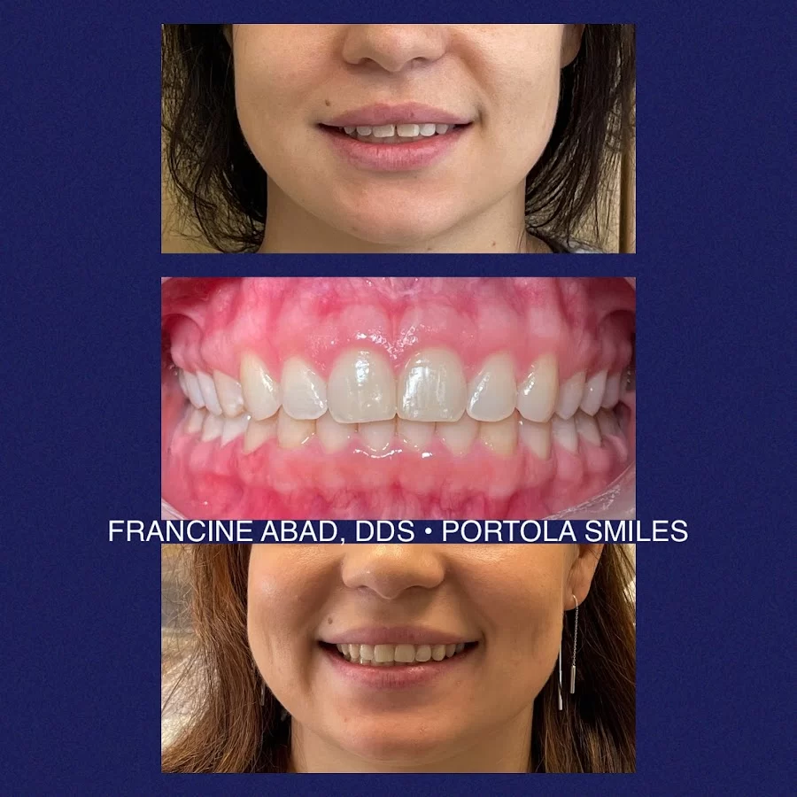 Portola Smiles Picture 8