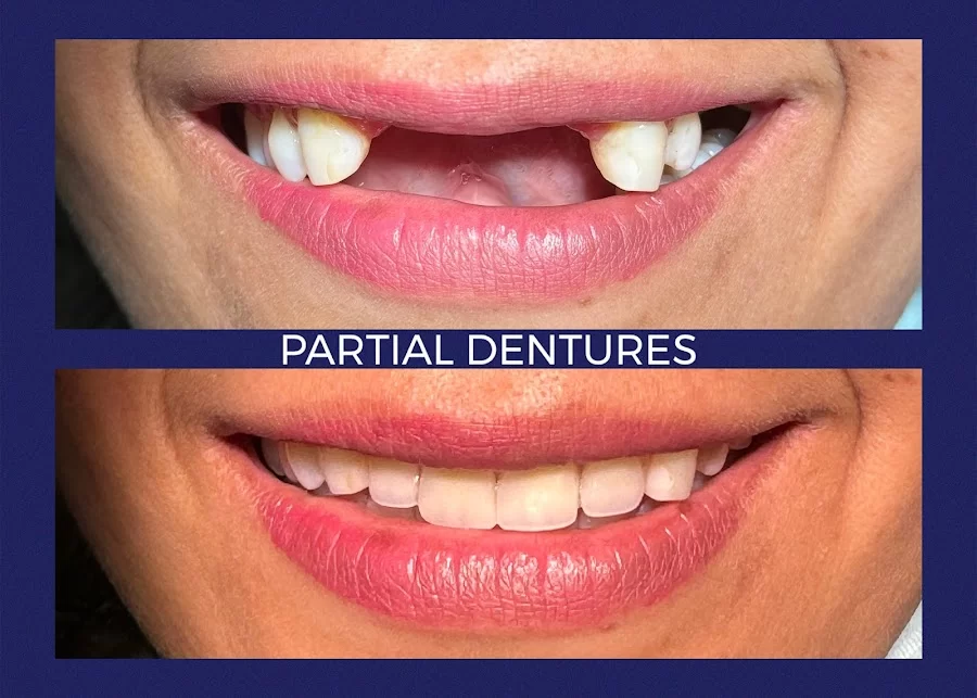 Portola Smiles Picture 4