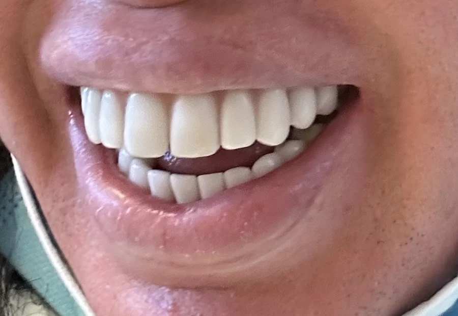 Sedation and Implant Dentistry Las Vegas Picture 2