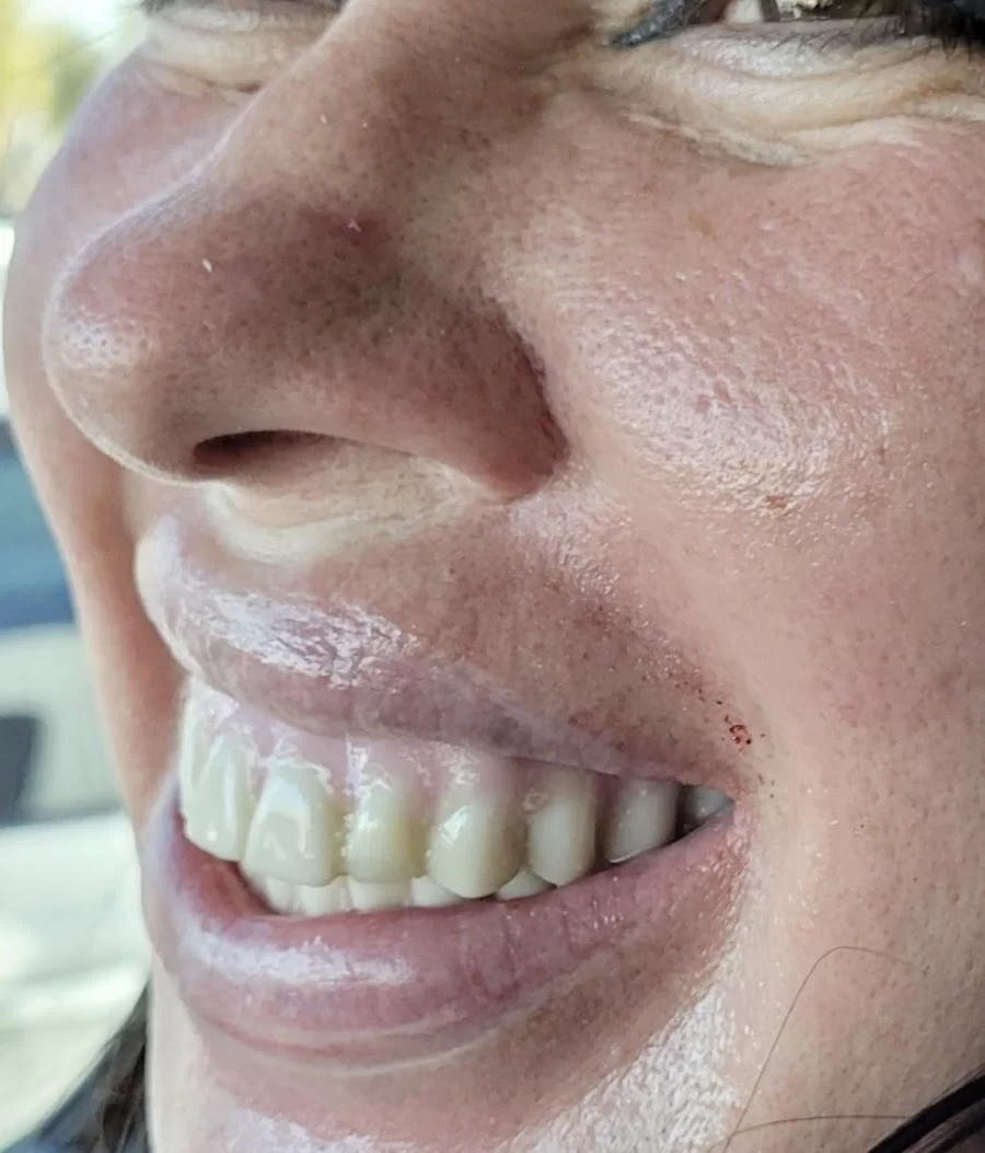 Sedation and Implant Dentistry Las Vegas Picture 6