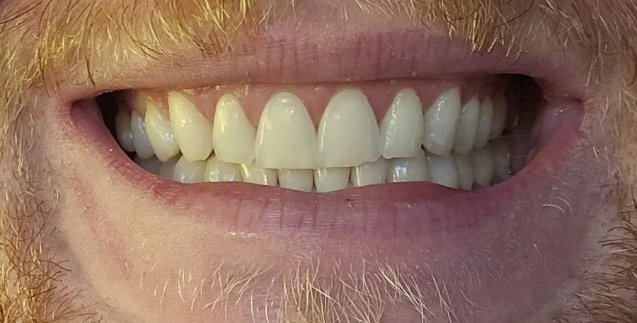 Hall Dental Studio Picture 5