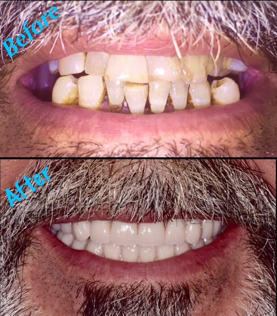 Sayreville Dental Studio - Mina Saif, DMD Picture 8