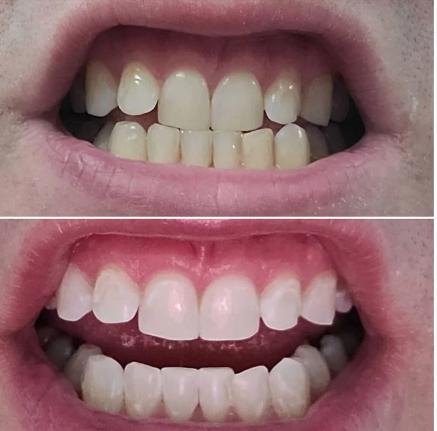 Fords Family Dental Care Picture 3