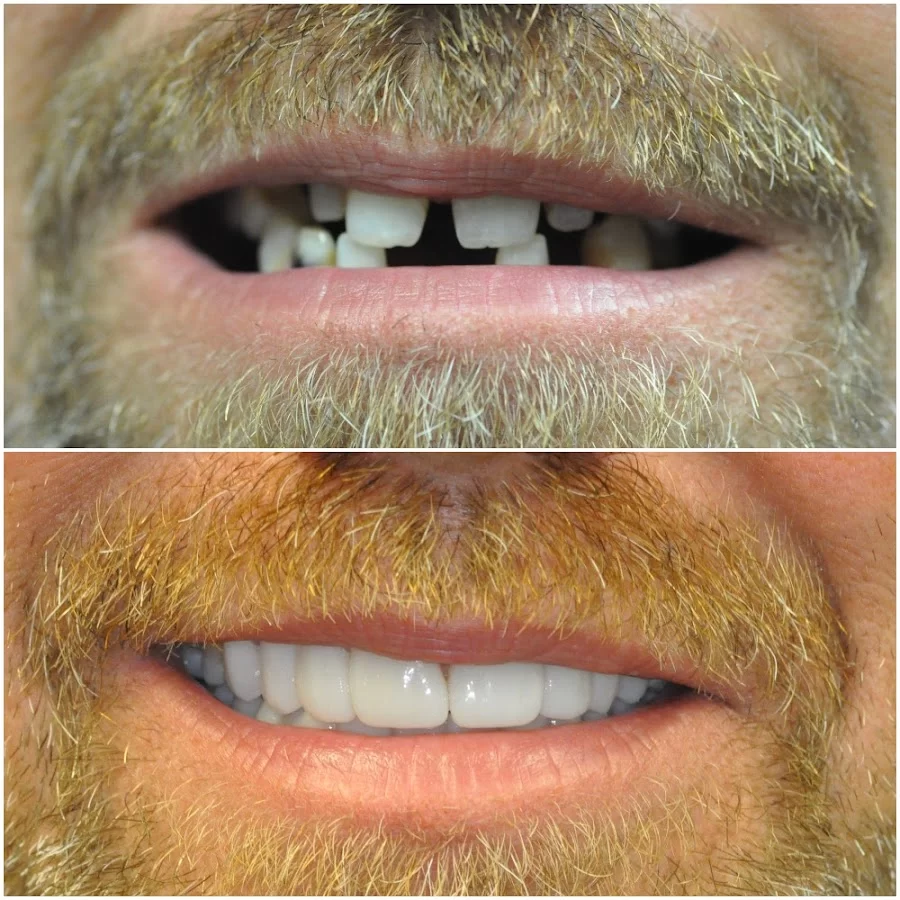 Nashville Cosmetic and Implant Dentistry Picture 10