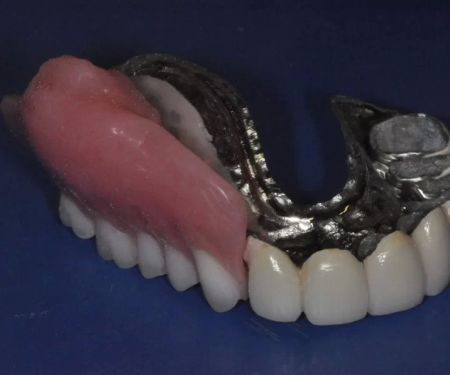 Nashville Cosmetic and Implant Dentistry