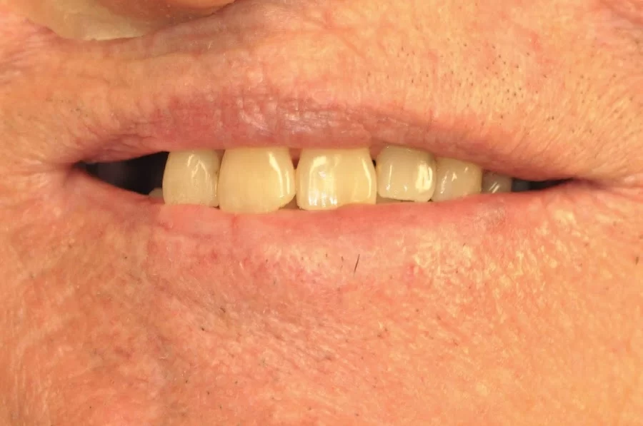 Nashville Cosmetic and Implant Dentistry Picture 5