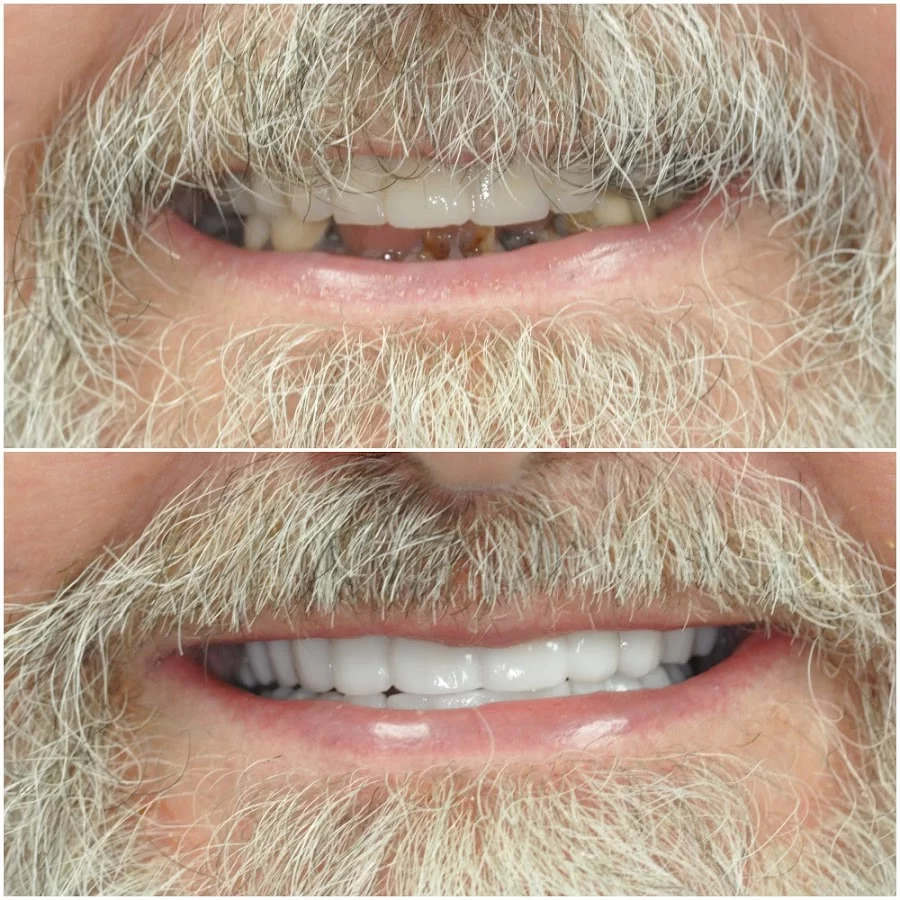 Nashville Cosmetic and Implant Dentistry Picture 9