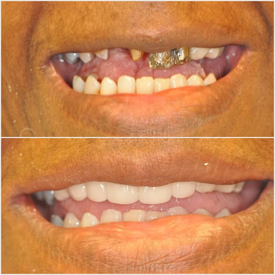 Nashville Cosmetic and Implant Dentistry Picture 8