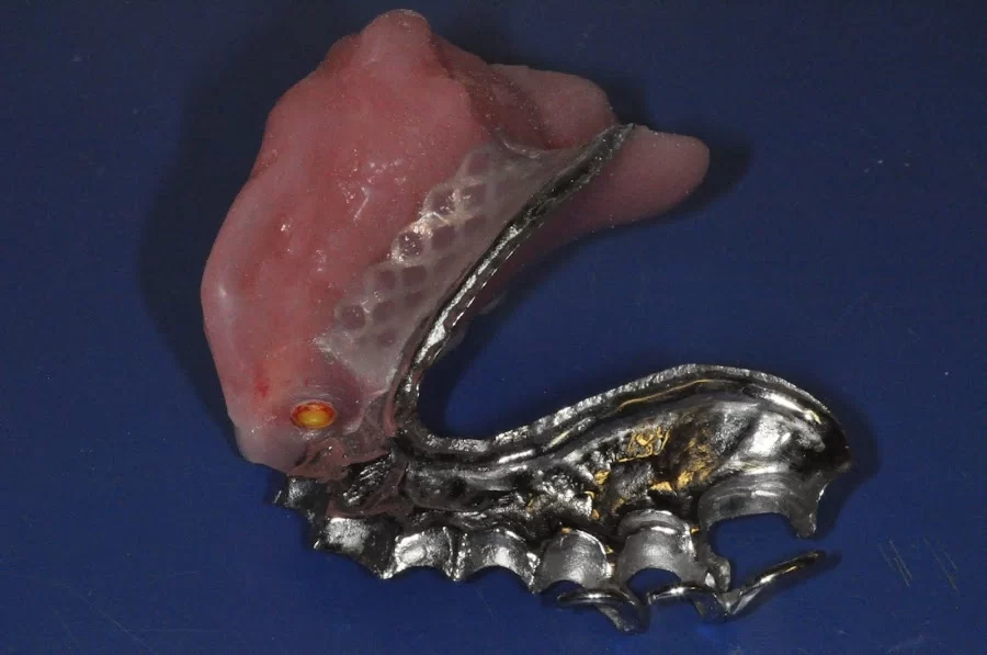 Nashville Cosmetic and Implant Dentistry Picture 4