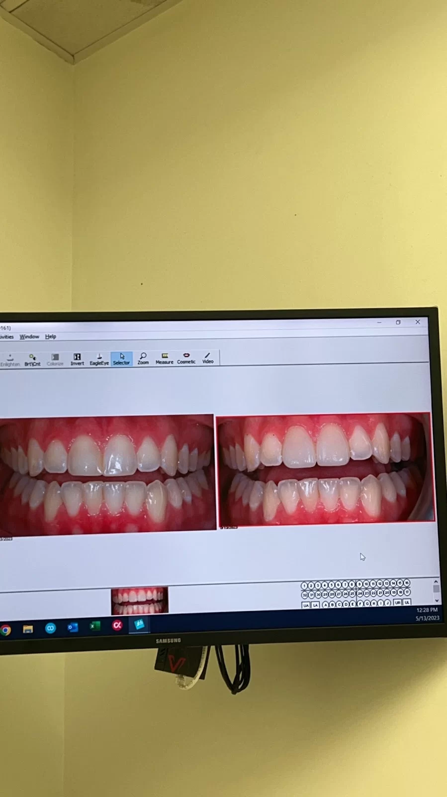 Frank Orlando DDS, FAGD, FICOI Picture 8