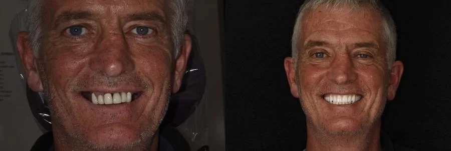 Brooklyn Heights Dental: Eugene D. Stanislaus, DDS Picture 3