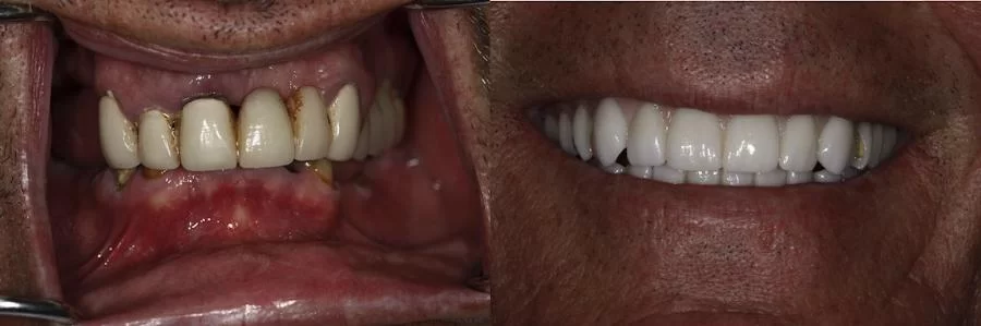 Brooklyn Heights Dental: Eugene D. Stanislaus, DDS Picture 4
