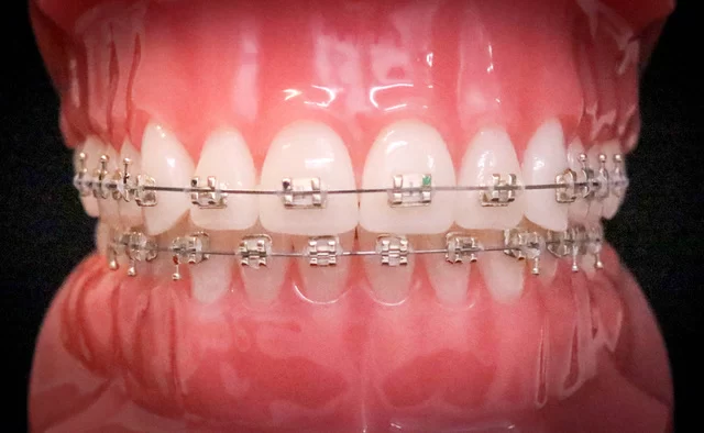 Dentistry Apache Junction Dr. Abedi's Family and Cosmetic Picture 2