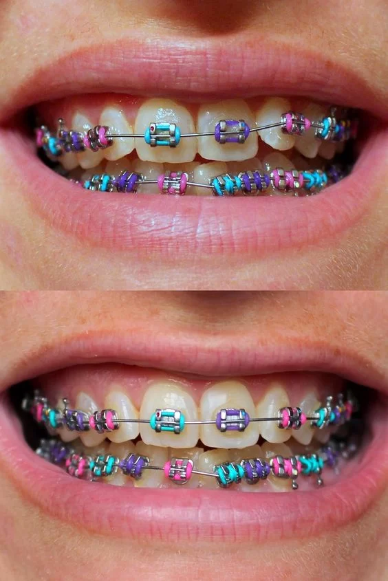 Dentistry Apache Junction Dr. Abedi's Family and Cosmetic Picture 3