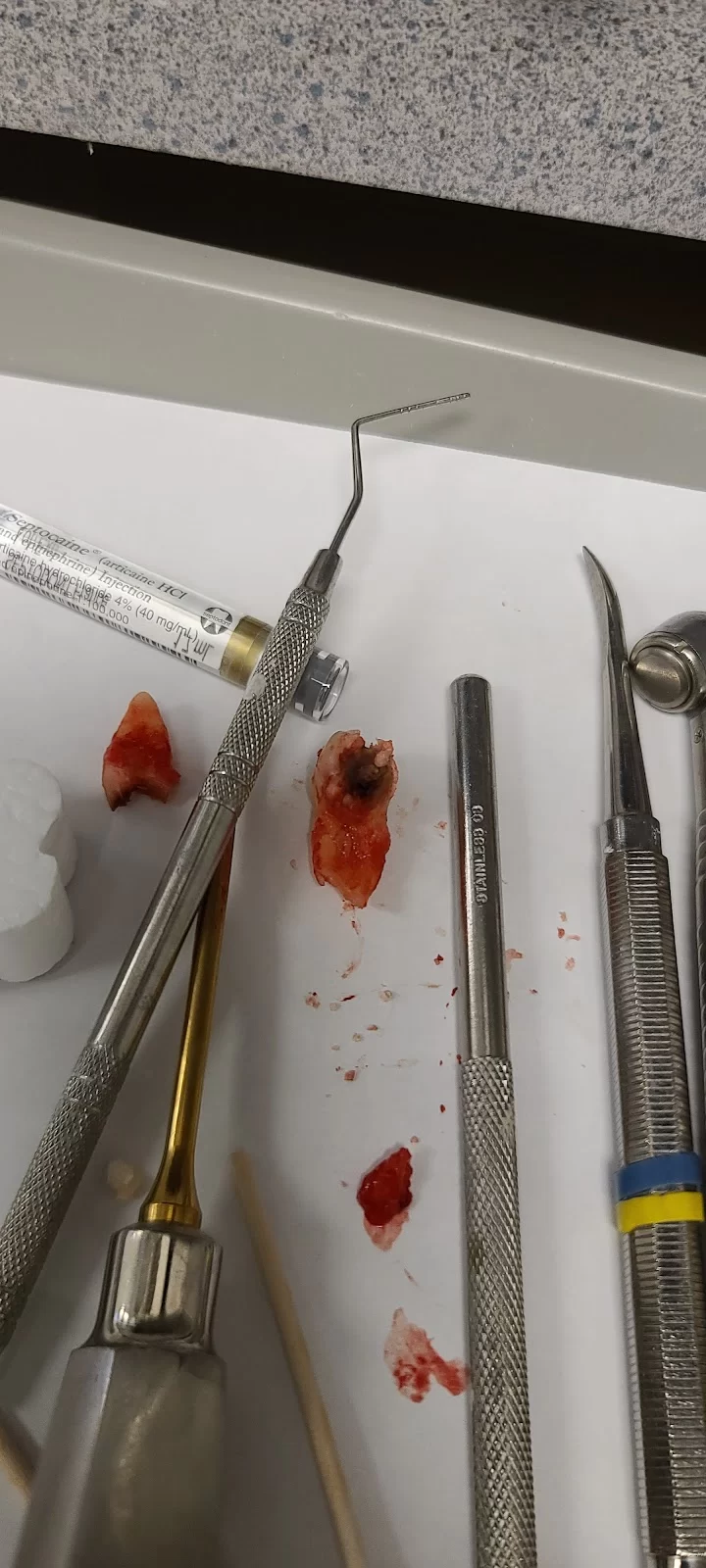 Comfort Dental Sawmill - Your Trusted Dentist in Dublin Picture 3