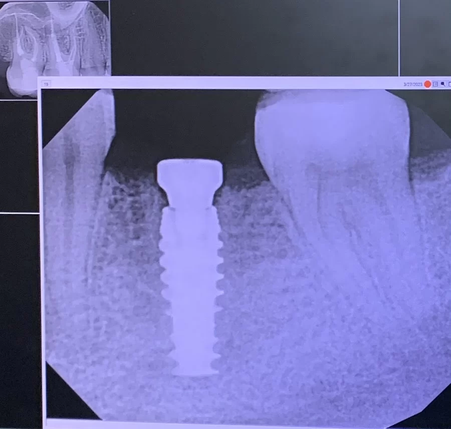Triangle Periodontics Picture 2