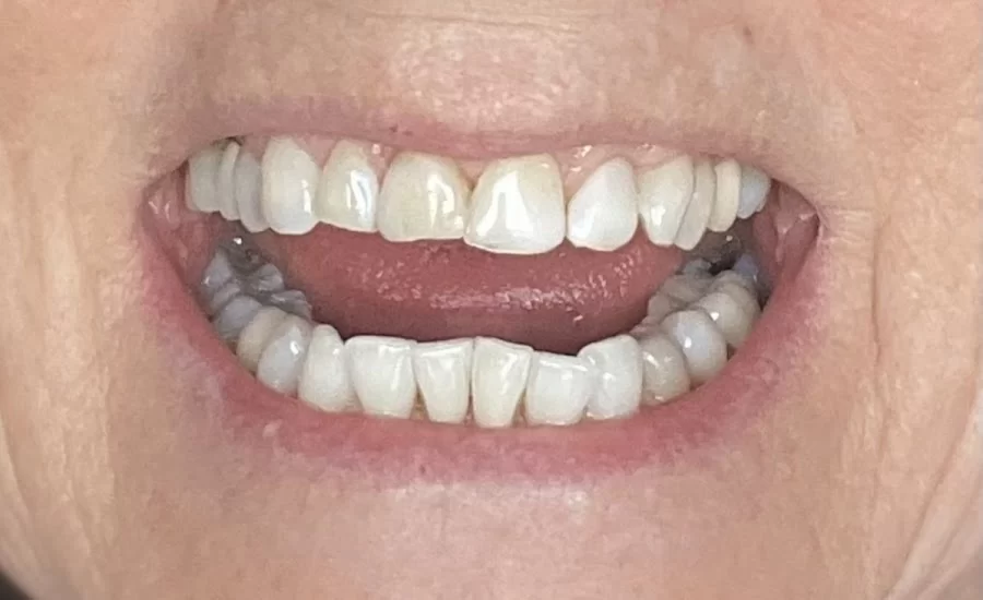 Glamm Dentistry Picture 1