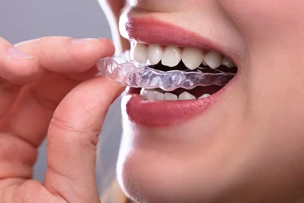 Weaver Dentistry Picture 1