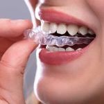 Weaver Dentistry