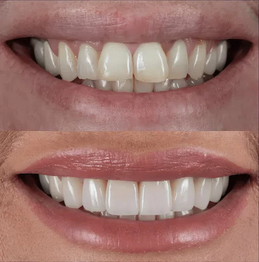Warner Parks Family Dental Picture 2