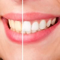 Bellevue Dental Care ico