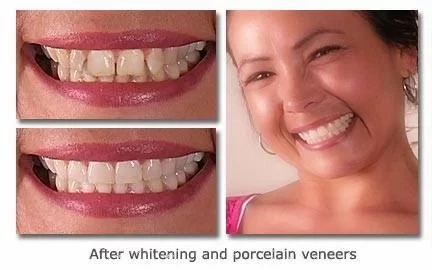 Cary Implant and General Dentistry Picture 1