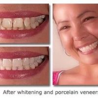 Cary Implant and General Dentistry ico