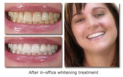 Cary Implant and General Dentistry Picture 2