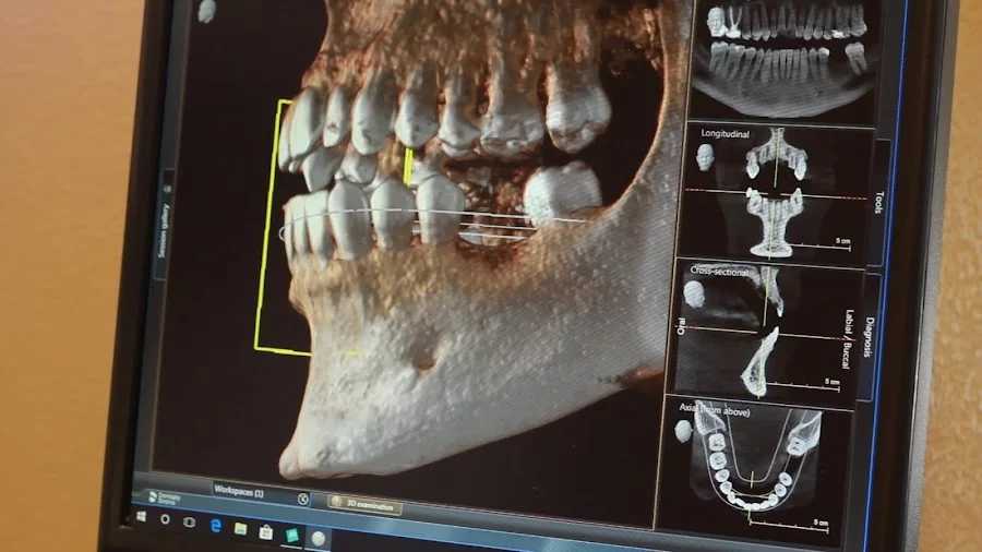 Darren G. Koch, DDS, PA Picture 4