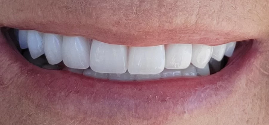 Artistic Dentistry - Chandler Picture 2