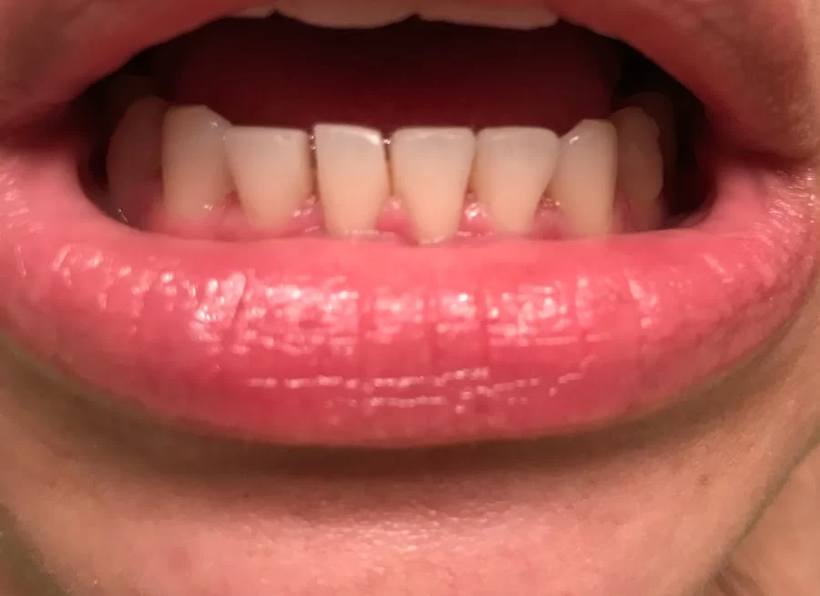 Westview Dental Center and Fastbraces® Picture 3