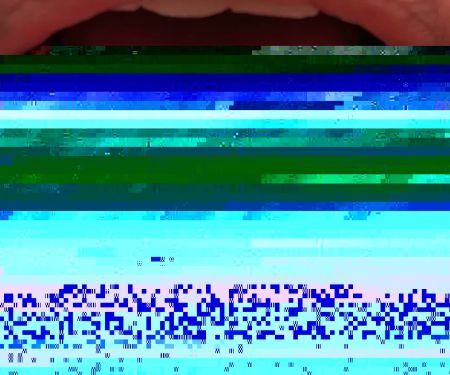 Westview Dental Center and Fastbracesu00ae