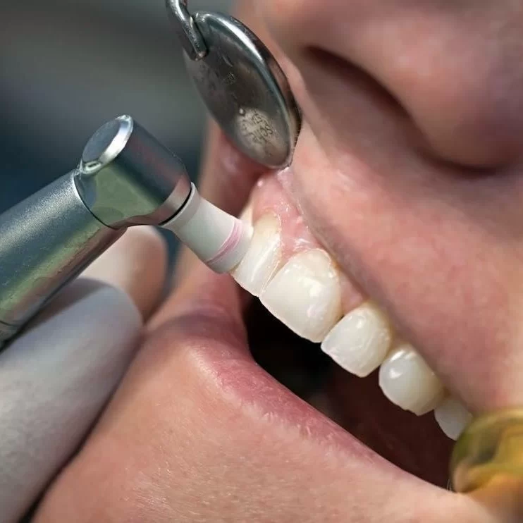 Westview Dental Center and Fastbraces® Picture 2
