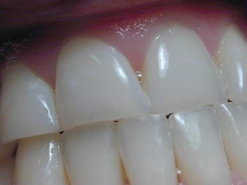 Alpenglow Dental Picture 7