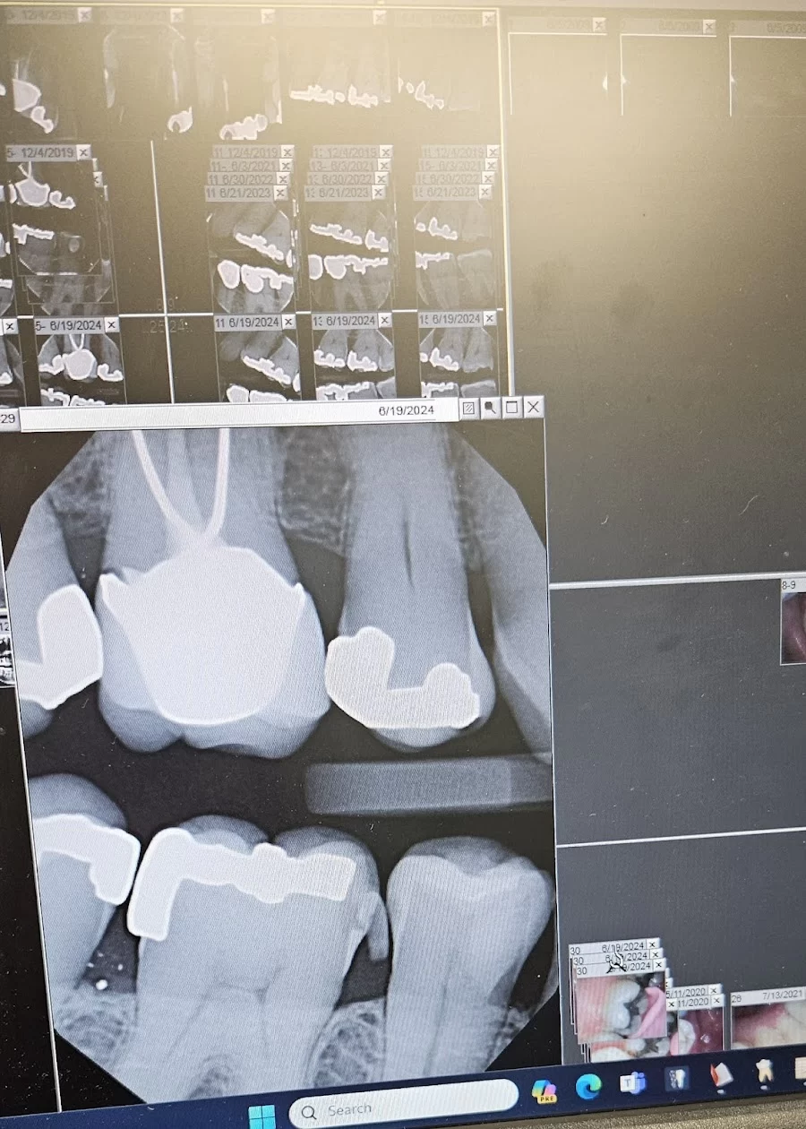 Chandler Dental Health Picture 6