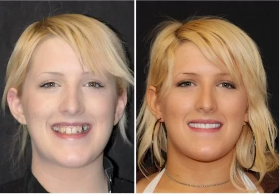 Intermountain Smiles Picture 2