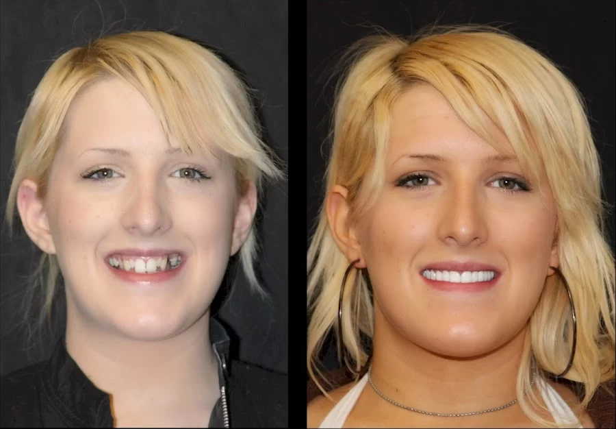 Intermountain Smiles Picture 6