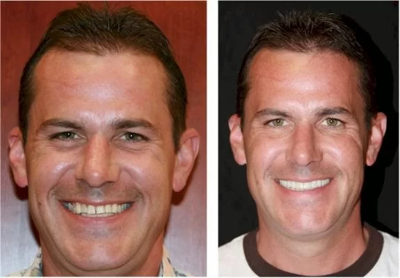 Intermountain Smiles Picture 3