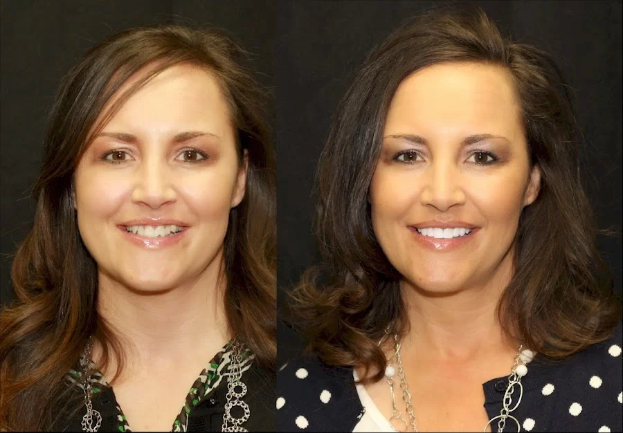Intermountain Smiles Picture 7