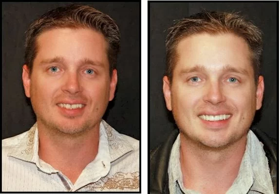 Intermountain Smiles Picture 1