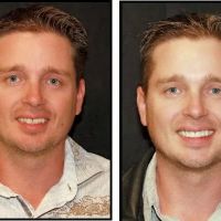Intermountain Smiles ico
