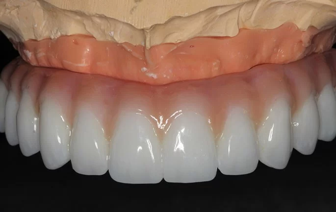Pony Express Dental & Orthodontics of Daybreak Picture 2