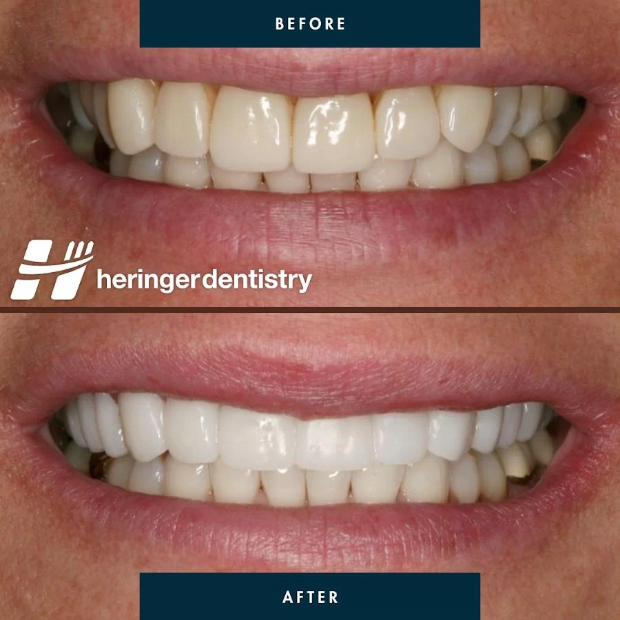 Heringer Dentistry LLC Picture 10