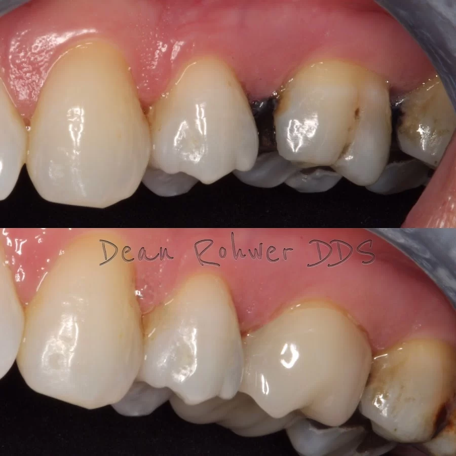 Dean Rohwer DDS Picture 4