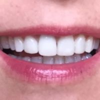 Creekstone Dental ico