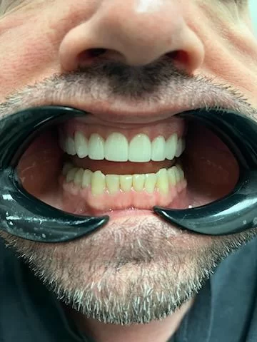 Impressions Dental | Chandler Dentist Picture 1
