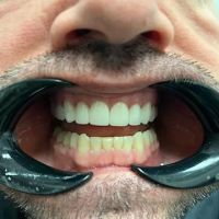 Impressions Dental | Chandler Dentist ico