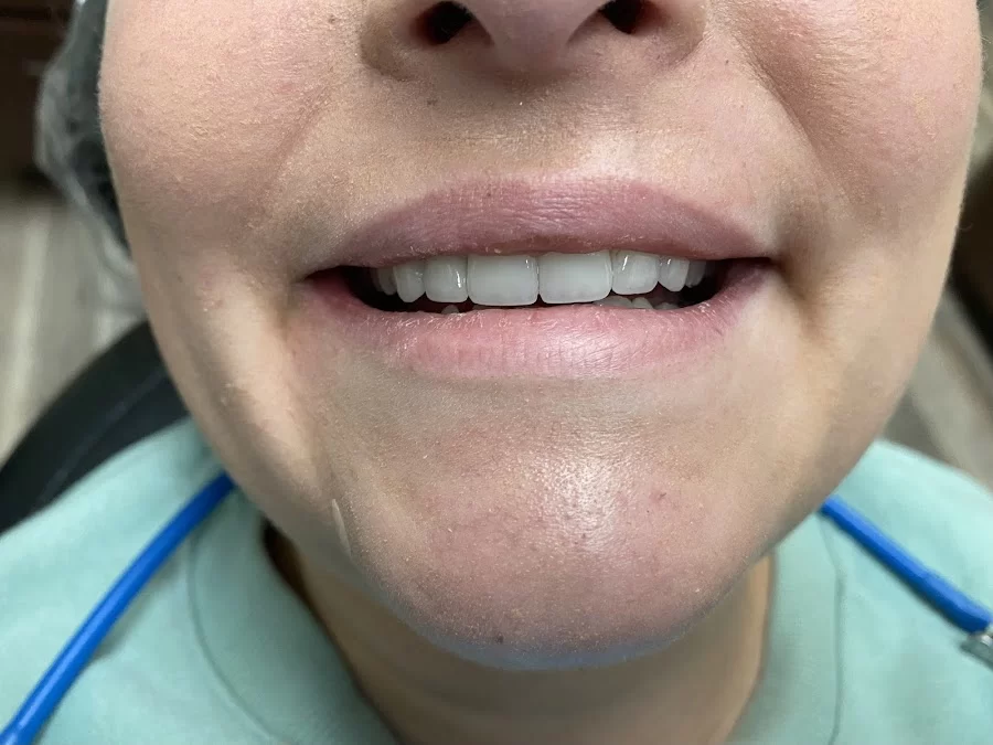 Impressions Dental | Chandler Dentist Picture 6
