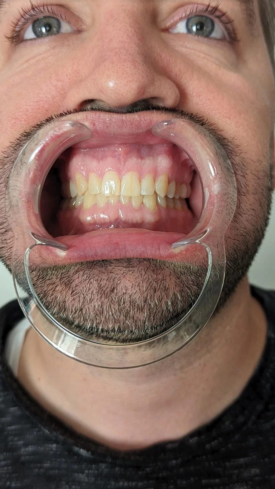 Impressions Dental | Chandler Dentist Picture 10